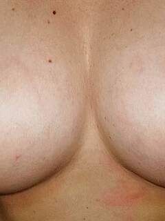 photo gallery id 175421