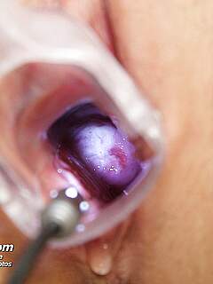 photo gallery id 255947