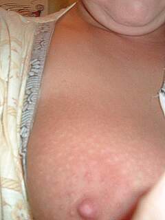 photo gallery id 281031