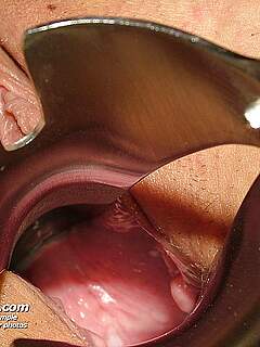 photo gallery id 314351