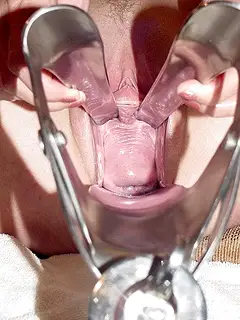 photo gallery id 209606