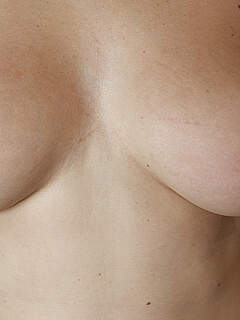 photo gallery id 263753